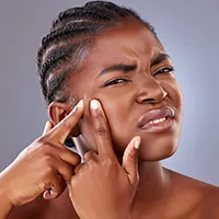 Acne Treatment at Refine Skin and Body Clinic.