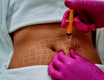 Pcdc Fat Dissolving at Refine Skin and Body Clinic.