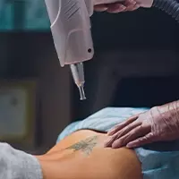 How Laser Hair Removal Works: Benefits, Myths, and What to Expect