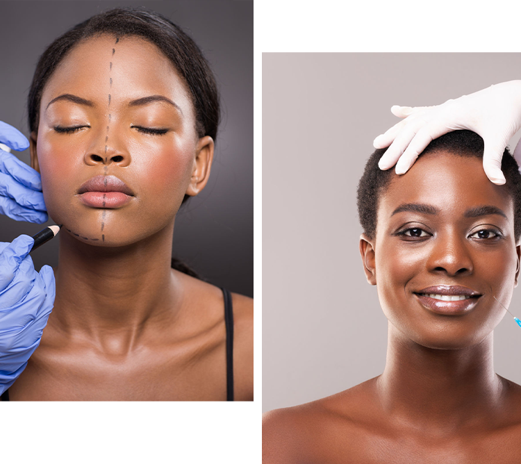Dermal Fillers at Refine Skin and Body Clinic.